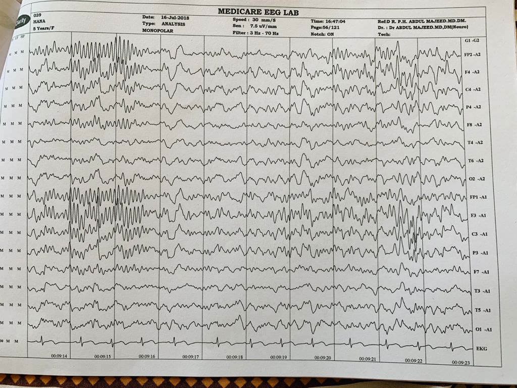 Patient Story
